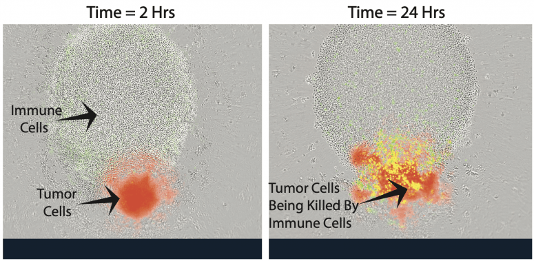 Immune cells, which look like small, clear circles, next to a small red sphere of neuroblastoma (cancer) cells. IMAGE COURTESY OF AMY ERBE