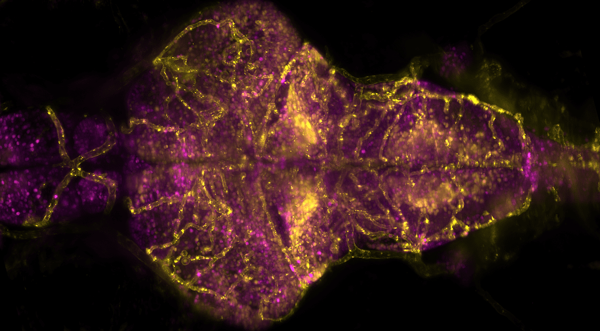 Vascular system and calcium levels in the larval zebrafish brain, recorded by Michael Weber (Morgridge Institute for Research) using a Flamingo T-SPIM light sheet microscope. Specimen kindly provided by Armin Bahl (Engert Lab, Harvard University; now University of Konstanz).