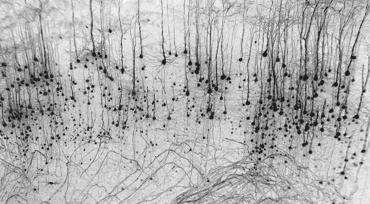 Neuronal forest by Marko Pende from the BINA 2023 Image Contest