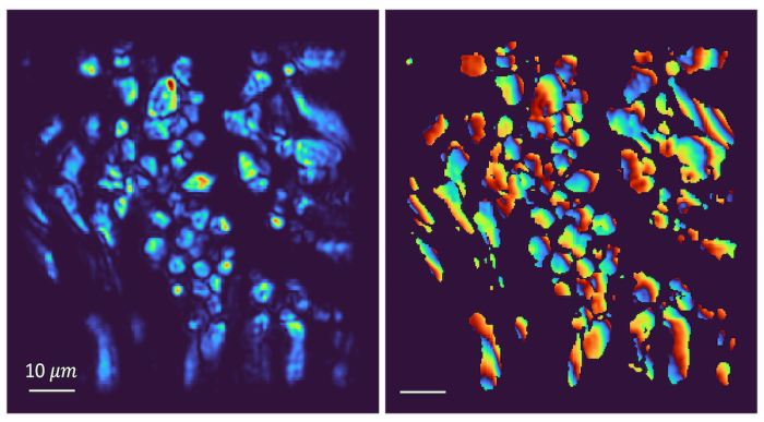 Osteoblasts in developing bone are imaged using third harmonic generation to produce full intensity (left) and full phase (right) images.